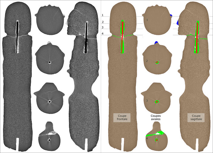 On the left, thin slices in the three planes (frontal-axial-sagittal planes); on the right the same slices coloured to show restoration in blue, glue and cement in green and concrete reinforcing in red.