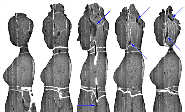 Sagittal thin slices