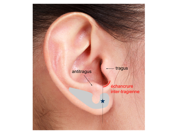 Zone privilégiée du piercing sur l'oreille