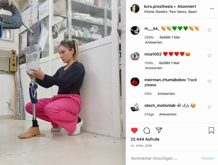 One of the Instagram accounts to follow in 2020: kcrs.prosthesis from Alba Cáceres (picture courtesy of Alba Cáceres)