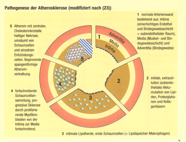 Cholesterin: Oft zu viel aber nie zu wenig. Copyright Bestfoods Ernährungs Forum 1999