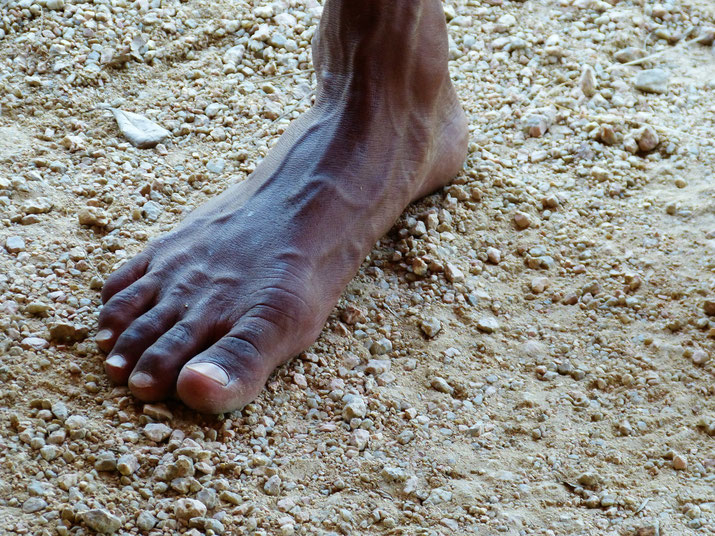 Indigenous Australian foot