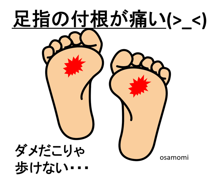 足指の付根が痛い!足膝専門の昭島市オサモミ整体院。