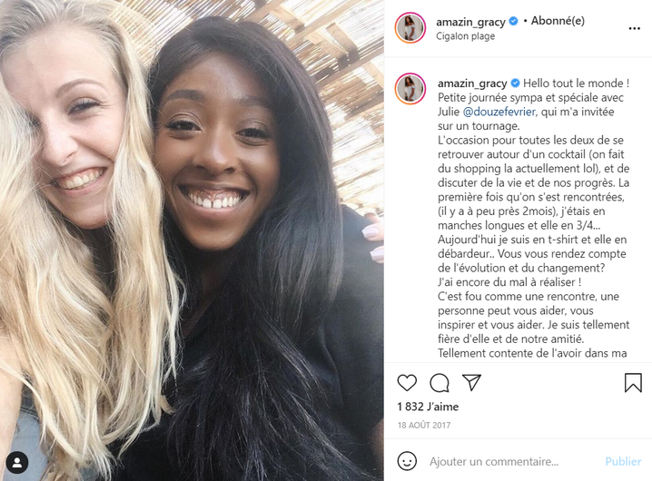 photo, influenceuse, grande brûlée