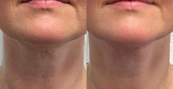 Sarah Parkes Threads neck skin clinic 