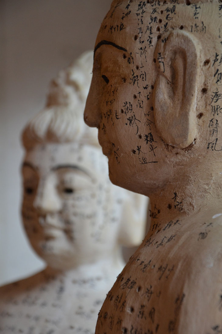 In Nürnberg und Fürth Behandlung,Therapie und Hilfe von chronischen Rückenschmerzen,Depressionen,Angst,Panik und Heuschnupfen mit Akupunktur,TCM und Hypnose von Heilpraktiker Trojahn
