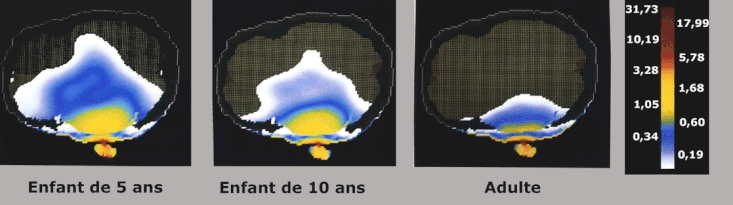 wifi cerveau enfant