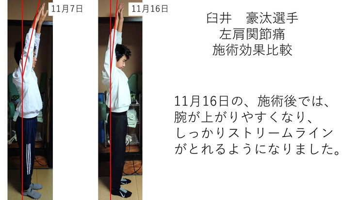 肩関節の痛み 姿勢 肩甲骨 肩甲骨痛み 背中の痛み 野球肩の原因 野球肩原因 野球肩治し方 野球肩体操 野球肩ストレッチ 野球 野球肩 肩が痛い ピッチャー リトルリーガーズショルダー 腱板損傷 投球傷害 水泳 競泳 腰痛 分離症 分離すべり症 水泳肩スイマーズショルダー 水泳肩 スイマーズショルダー治療 スイマーズショルダー治るのか 岐阜 岐阜市 岐阜市茜部 岐阜市東鶉 岐阜市南鶉 岐阜市中鶉 岐阜市柳津町 羽島市 羽島郡 笠松町 岐南町 茜部 鶉 東鶉 中鶉 南鶉 柳津 笠松