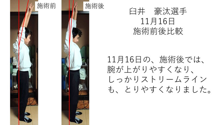 肩関節の痛み 姿勢 肩甲骨 肩甲骨痛み 背中の痛み 野球肩の原因 野球肩原因 野球肩治し方 野球肩体操 野球肩ストレッチ 野球 野球肩 肩が痛い ピッチャー リトルリーガーズショルダー 腱板損傷 投球傷害 水泳 競泳 腰痛 分離症 分離すべり症 水泳肩スイマーズショルダー 水泳肩 スイマーズショルダー治療 スイマーズショルダー治るのか 岐阜 岐阜市 岐阜市茜部 岐阜市東鶉 岐阜市南鶉 岐阜市中鶉 岐阜市柳津町 羽島市 羽島郡 笠松町 岐南町 茜部 鶉 東鶉 中鶉 南鶉 柳津 笠松