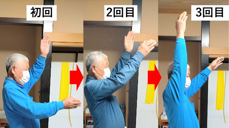 五十肩の施術例。初回から3回目に肩の可動域が改善し、腕を痛み無く上げられるようになった症例