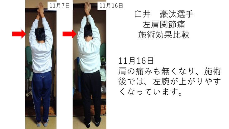 肩関節の痛み 姿勢 肩甲骨 肩甲骨痛み 背中の痛み 野球肩の原因 野球肩原因 野球肩治し方 野球肩体操 野球肩ストレッチ 野球 野球肩 肩が痛い ピッチャー リトルリーガーズショルダー 腱板損傷 投球傷害 水泳 競泳 腰痛 分離症 分離すべり症 水泳肩スイマーズショルダー 水泳肩 スイマーズショルダー治療 スイマーズショルダー治るのか 岐阜 岐阜市 岐阜市茜部 岐阜市東鶉 岐阜市南鶉 岐阜市中鶉 岐阜市柳津町 羽島市 羽島郡 笠松町 岐南町 茜部 鶉 東鶉 中鶉 南鶉 柳津 笠松