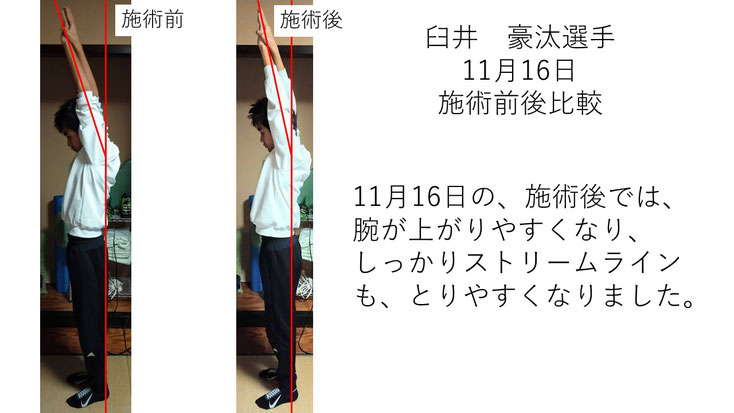 肩関節の痛み　姿勢　肩甲骨　肩甲骨痛み　背中の痛み　野球肩の原因　野球肩原因　野球肩治し方　野球肩体操　野球肩ストレッチ　野球　野球肩　肩が痛い　ピッチャー　リトルリーガーズショルダー　腱板損傷　投球傷害　水泳　競泳　腰痛　分離症　分離すべり症　水泳肩スイマーズショルダー　水泳肩　スイマーズショルダー治療　スイマーズショルダー治るのか　岐阜　岐阜市　岐阜市茜部　岐阜市東鶉　岐阜市南鶉　岐阜市中鶉　岐阜市柳津町　羽島市　羽島郡　笠松町　岐南町　茜部　鶉　東鶉　中鶉　南鶉　柳津　笠松　