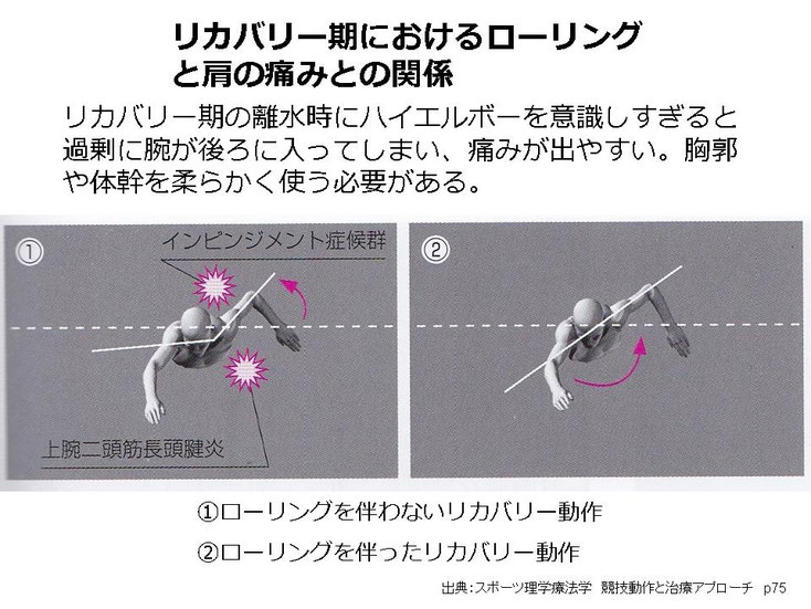 肩関節の痛み　姿勢　肩甲骨　肩甲骨痛み　背中の痛み　野球肩の原因　野球肩原因　野球肩治し方　野球肩体操　野球肩ストレッチ　野球　野球肩　肩が痛い　ピッチャー　リトルリーガーズショルダー　腱板損傷　投球傷害　水泳　競泳　腰痛　分離症　分離すべり症　水泳肩スイマーズショルダー　水泳肩　スイマーズショルダー治療　スイマーズショルダー治るのか　岐阜　岐阜市　岐阜市茜部　岐阜市東鶉　岐阜市南鶉　岐阜市中鶉　岐阜市柳津町　羽島市　羽島郡　笠松町　岐南町　茜部　鶉　東鶉　中鶉　南鶉　柳津　笠松　