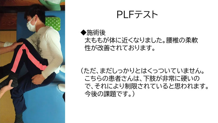 肩関節の痛み　姿勢　肩甲骨　肩甲骨痛み　背中の痛み　野球肩の原因　野球肩原因　野球肩治し方　野球肩体操　野球肩ストレッチ　野球　野球肩　肩が痛い　ピッチャー　リトルリーガーズショルダー　腱板損傷　投球傷害　水泳　競泳　腰痛　分離症　分離すべり症　水泳肩スイマーズショルダー　水泳肩　スイマーズショルダー治療　スイマーズショルダー治るのか　岐阜　岐阜市　岐阜市茜部　岐阜市東鶉　岐阜市南鶉　岐阜市中鶉　岐阜市柳津町　羽島市　羽島郡　笠松町　岐南町　茜部　鶉　東鶉　中鶉　南鶉　柳津　笠松　