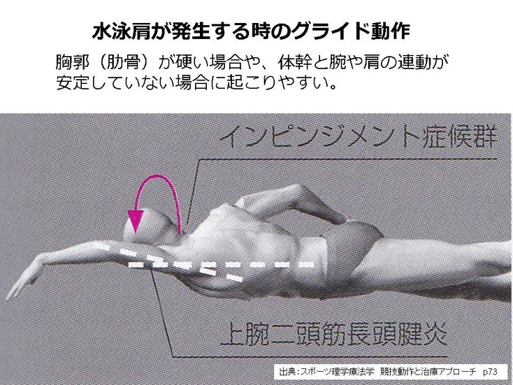 野球　野球肩　肩が痛い　ピッチャー　リトルリーガーズショルダー　腱板損傷　投球傷害　水泳　競泳　腰痛　分離症　分離すべり症　水泳肩スイマーズショルダー　水泳肩　スイマーズショルダー治療　スイマーズショルダー治るのか　岐阜　岐阜市　岐阜市茜部　岐阜市鶉　岐阜市柳津　羽島市　羽島郡　笠松町　岐南町　茜部　鶉　柳津　笠松　