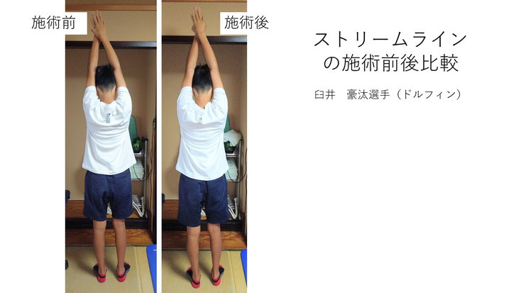 肩関節の痛み　姿勢　肩甲骨　肩甲骨痛み　背中の痛み　野球肩の原因　野球肩原因　野球肩治し方　野球肩体操　野球肩ストレッチ　野球　野球肩　肩が痛い　ピッチャー　リトルリーガーズショルダー　腱板損傷　投球傷害　水泳　競泳　腰痛　分離症　分離すべり症　水泳肩スイマーズショルダー　水泳肩　スイマーズショルダー治療　スイマーズショルダー治るのか　岐阜　岐阜市　岐阜市茜部　岐阜市東鶉　岐阜市南鶉　岐阜市中鶉　岐阜市柳津町　羽島市　羽島郡　笠松町　岐南町　茜部　鶉　東鶉　中鶉　南鶉　柳津　笠松　