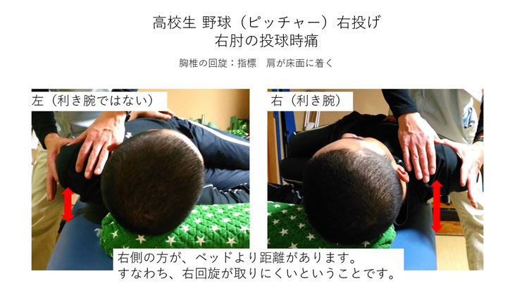 肩関節の痛み　姿勢　肩甲骨　肩甲骨痛み　背中の痛み　野球肩の原因　野球肩原因　野球肩治し方　野球肩体操　野球肩ストレッチ　野球　野球肩　肩が痛い　ピッチャー　リトルリーガーズショルダー　腱板損傷　投球傷害　水泳　競泳　腰痛　分離症　分離すべり症　水泳肩スイマーズショルダー　水泳肩　スイマーズショルダー治療　スイマーズショルダー治るのか　岐阜　岐阜市　岐阜市茜部　岐阜市東鶉　岐阜市南鶉　岐阜市中鶉　岐阜市柳津町　羽島市　羽島郡　笠松町　岐南町　茜部　鶉　東鶉　中鶉　南鶉　柳津　笠松　