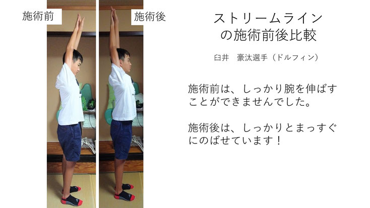 肩関節の痛み　姿勢　肩甲骨　肩甲骨痛み　背中の痛み　野球肩の原因　野球肩原因　野球肩治し方　野球肩体操　野球肩ストレッチ　野球　野球肩　肩が痛い　ピッチャー　リトルリーガーズショルダー　腱板損傷　投球傷害　水泳　競泳　腰痛　分離症　分離すべり症　水泳肩スイマーズショルダー　水泳肩　スイマーズショルダー治療　スイマーズショルダー治るのか　岐阜　岐阜市　岐阜市茜部　岐阜市東鶉　岐阜市南鶉　岐阜市中鶉　岐阜市柳津町　羽島市　羽島郡　笠松町　岐南町　茜部　鶉　東鶉　中鶉　南鶉　柳津　笠松　