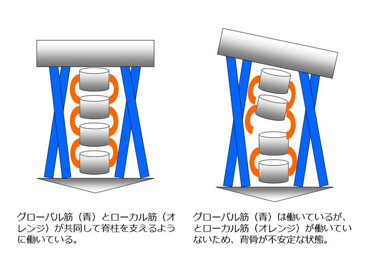 水泳　競泳　肩痛　肩が痛い　インピンジメント症候群　腰が痛い　腰痛　分離症　分離すべり症　水泳肩スイマーズショルダー　水泳肩　スイマーズショルダー治療　スイマーズショルダー治るのか　岐阜　岐阜市　岐阜市茜部　岐阜市鶉　岐阜市柳津　羽島市　羽島郡　笠松町　岐南町　茜部　鶉　柳津　笠松　