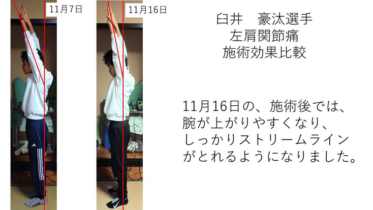 肩関節の痛み 姿勢 肩甲骨 肩甲骨痛み 背中の痛み 野球肩の原因 野球肩原因 野球肩治し方 野球肩体操 野球肩ストレッチ 野球 野球肩 肩が痛い ピッチャー リトルリーガーズショルダー 腱板損傷 投球傷害 水泳 競泳 腰痛 分離症 分離すべり症 水泳肩スイマーズショルダー 水泳肩 スイマーズショルダー治療 スイマーズショルダー治るのか 岐阜 岐阜市 岐阜市茜部 岐阜市東鶉 岐阜市南鶉 岐阜市中鶉 岐阜市柳津町 羽島市 羽島郡 笠松町 岐南町 茜部 鶉 東鶉 中鶉 南鶉 柳津 笠松