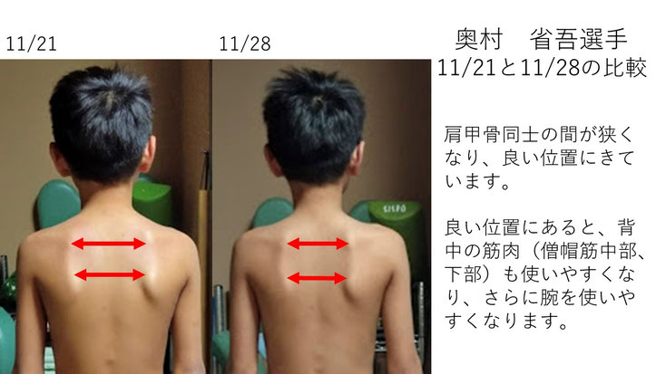 肩関節の痛み　姿勢　肩甲骨　肩甲骨痛み　背中の痛み　野球肩の原因　野球肩原因　野球肩治し方　野球肩体操　野球肩ストレッチ　野球　野球肩　肩が痛い　ピッチャー　リトルリーガーズショルダー　腱板損傷　投球傷害　水泳　競泳　腰痛　分離症　分離すべり症　水泳肩スイマーズショルダー　水泳肩　スイマーズショルダー治療　スイマーズショルダー治るのか　岐阜　岐阜市　岐阜市茜部　岐阜市東鶉　岐阜市南鶉　岐阜市中鶉　岐阜市柳津町　羽島市　羽島郡　笠松町　岐南町　茜部　鶉　東鶉　中鶉　南鶉　柳津　笠松　