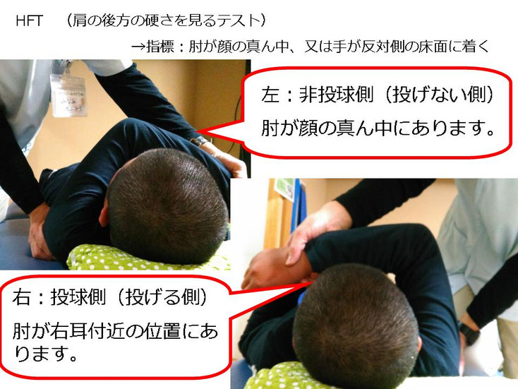 野球 野球肩 肩が痛い ピッチャー リトルリーガーズショルダー 腱板損傷 投球傷害 水泳 競泳 腰痛 分離症 分離すべり症 水泳肩スイマーズショルダー 水泳肩 スイマーズショルダー治療 スイマーズショルダー治るのか 岐阜 岐阜市 岐阜市茜部 岐阜市東鶉 岐阜市南鶉 岐阜市中鶉 岐阜市柳津町 羽島市 羽島郡 笠松町 岐南町 茜部 鶉 東鶉 中鶉 南鶉 柳津 笠松