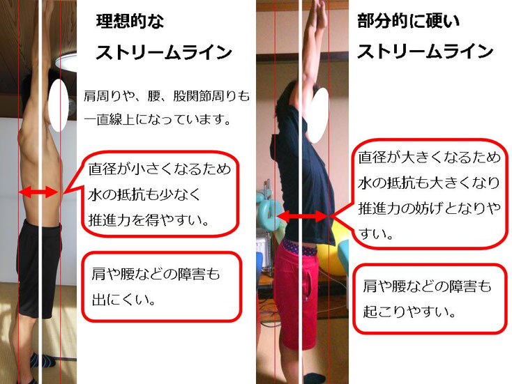 水泳　競泳　肩痛　肩が痛い　インピンジメント症候群　腰が痛い　腰痛　分離症　分離すべり症　水泳肩スイマーズショルダー　水泳肩　スイマーズショルダー治療　スイマーズショルダー治るのか　岐阜　岐阜市　岐阜市茜部　岐阜市鶉　岐阜市柳津　羽島市　羽島郡　笠松町　岐南町　茜部　鶉　柳津　笠松　