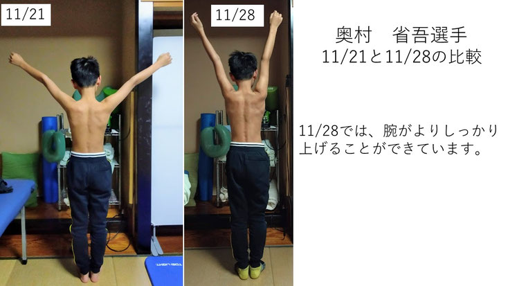 肩関節の痛み　姿勢　肩甲骨　肩甲骨痛み　背中の痛み　野球肩の原因　野球肩原因　野球肩治し方　野球肩体操　野球肩ストレッチ　野球　野球肩　肩が痛い　ピッチャー　リトルリーガーズショルダー　腱板損傷　投球傷害　水泳　競泳　腰痛　分離症　分離すべり症　水泳肩スイマーズショルダー　水泳肩　スイマーズショルダー治療　スイマーズショルダー治るのか　岐阜　岐阜市　岐阜市茜部　岐阜市東鶉　岐阜市南鶉　岐阜市中鶉　岐阜市柳津町　羽島市　羽島郡　笠松町　岐南町　茜部　鶉　東鶉　中鶉　南鶉　柳津　笠松　