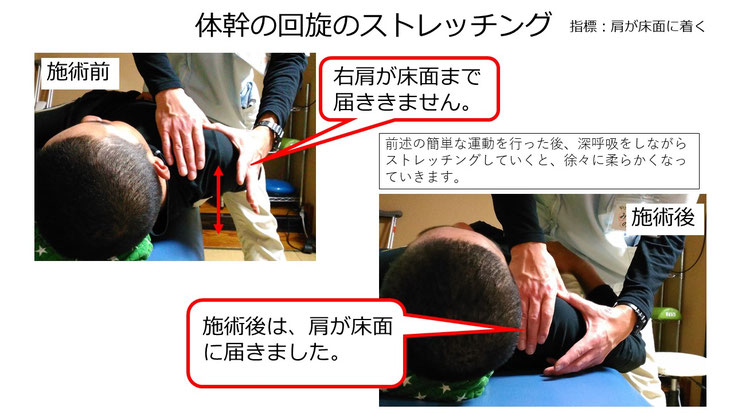 野球 野球肩 肩が痛い ピッチャー リトルリーガーズショルダー 腱板損傷 投球傷害 水泳 競泳 腰痛 分離症 分離すべり症 水泳肩スイマーズショルダー 水泳肩 スイマーズショルダー治療 スイマーズショルダー治るのか 岐阜 岐阜市 岐阜市茜部 岐阜市東鶉 岐阜市南鶉 岐阜市中鶉 岐阜市柳津町 羽島市 羽島郡 笠松町 岐南町 茜部 鶉 東鶉 中鶉 南鶉 柳津 笠松