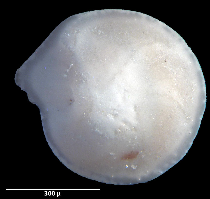 Foraminifere, Foraminifera, Bryozoa, Senckenberg, fossil, Stevns Klint, Dänemark, Maastrichtium