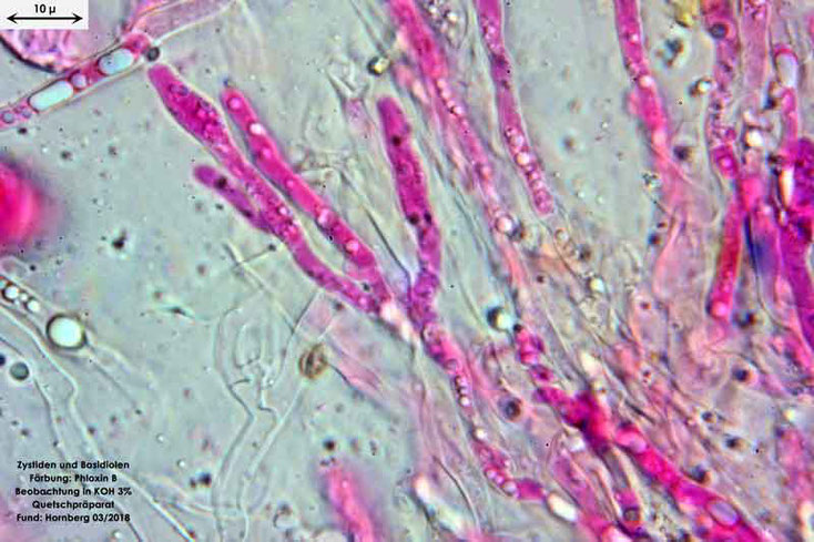 Bild 8 Zystiden und Basidiolen von Cylindrobasidium evolens, Objektiv Neofluar 100Öl, Vergrößerung 1000fach,