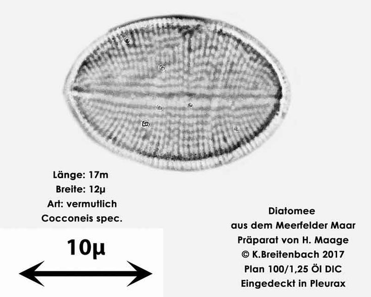 Bild 11 Diatomee aus dem Meerfelder Maar in der Eifel, Art: vermutlich Cocconeis spec.