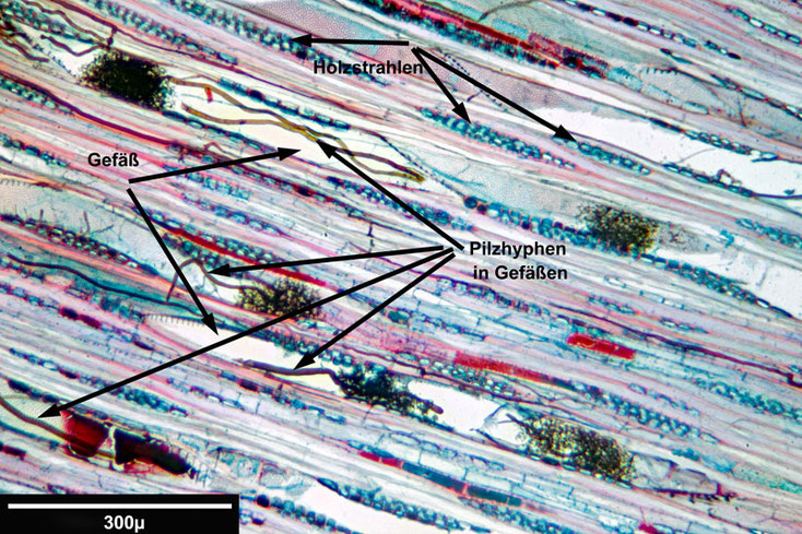 Birke - Weißbirke, Tangentialschnitt - in den Tracheiden sind die Pilzhyphen zu erkennen.