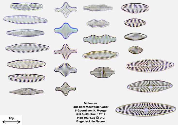 Bild 22 Diatomee aus dem Meerfelder Maar in der Eifel, Art: verschiedene