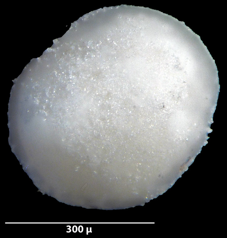 Foraminifere, Foraminifera, Bryozoa, Senckenberg, fossil, Stevns Klint, Dänemark, Maastrichtium