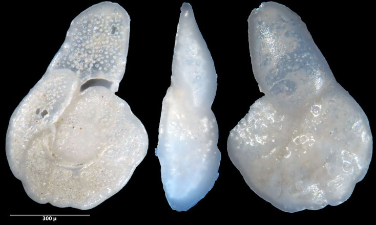 Foraminiferen, Foraminifera, Foras, Mikroskop, Senckenberg, Mittelmeer, Cibicidoides, 