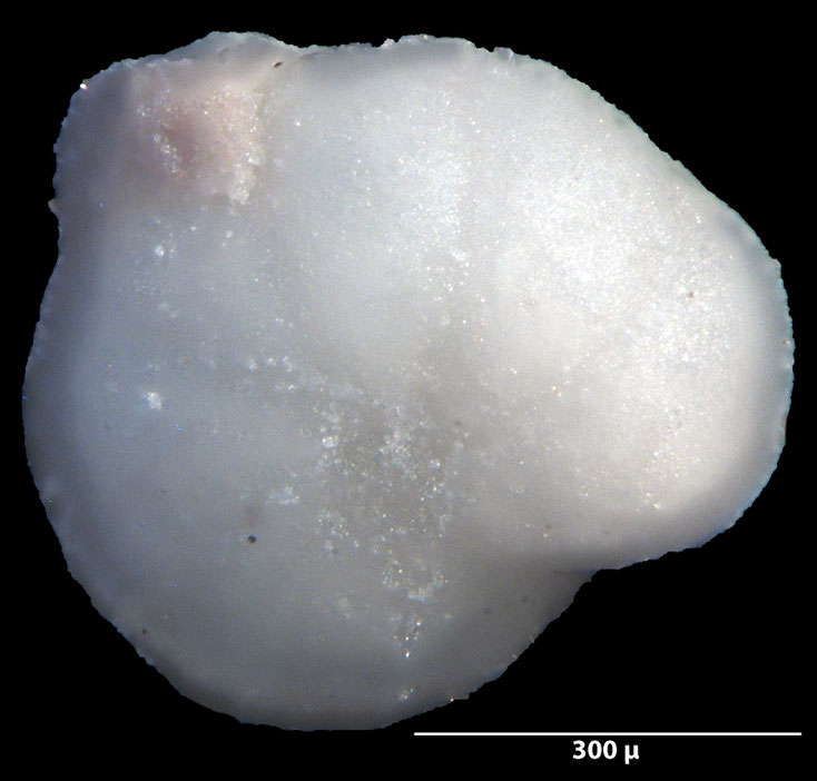 Foraminifere, Foraminifera, Bryozoa, Senckenberg, fossil, Stevns Klint, Dänemark, Maastrichtium