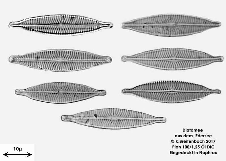 Bild 10 Diatomeen aus dem Edersee, verschiedene Aufnahmen, Art: vermutlich Navicula spec.