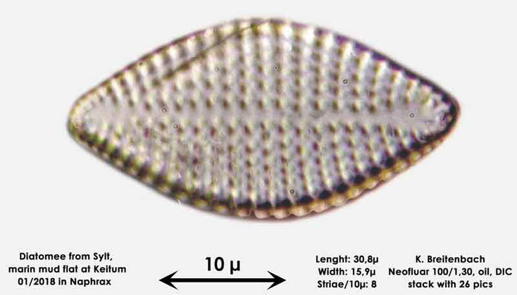 Bild 41 Diatomee aus Sylt/Keitum Watt, Art: Rhaphoneis amphiceros (Ehrenberg) Ehrenberg 1844
