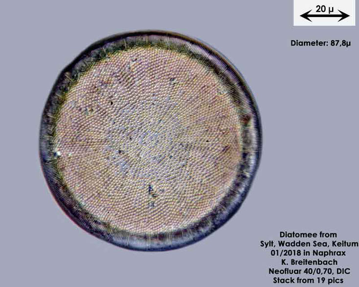 Bild 2 Diatomee aus Sylt/Keitum Watt, Art: Actinocyclus octonarius Ehrenberg (1837)