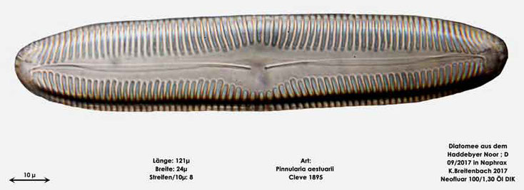 Bild 21 Diatomee aus dem Haddebyer Noor in Schleswig Holstein; Art: Pinnularia aestuarii Cleve 1895