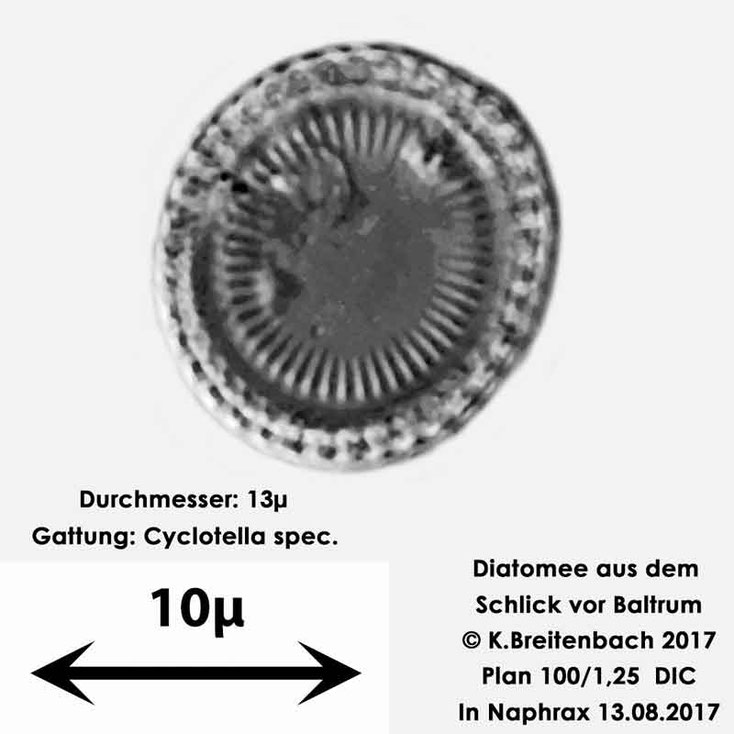 Bild 7 Diatomee aus dem Watt vor Baltrum; Gattung: vermutlich Cyclotella spec.