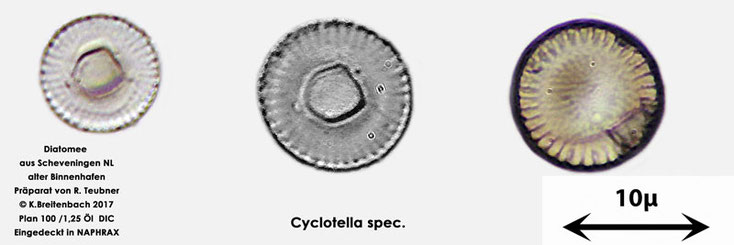 Bild 5 Diatomeen aus Scheveningen NL, Art vermutlich Cyclotella spec.