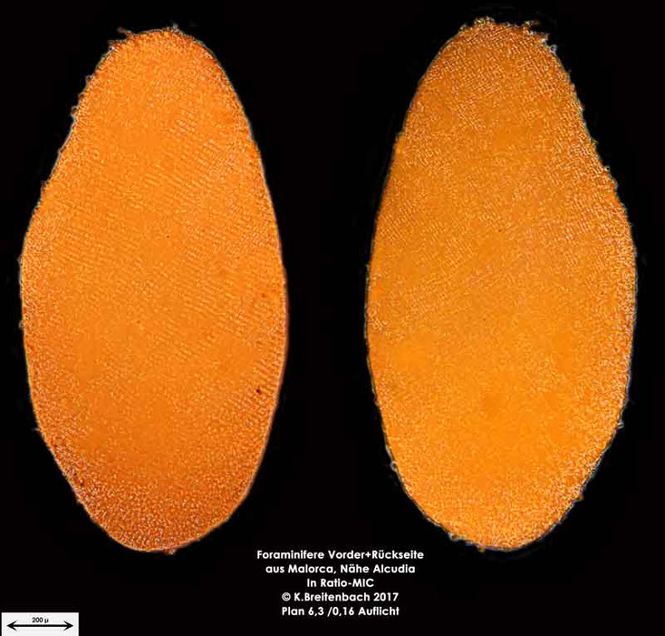 Bild 16 Foraminiferen aus Mallorca; Gattung: Unbestimmt von mir