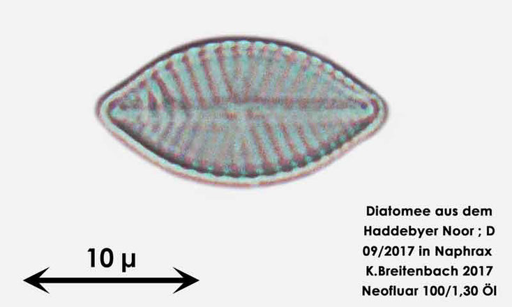 Bild 26 Diatomee aus dem Haddebyer Noor in Schleswig Holstein; Gattung: wurde von mir nicht bestimmt