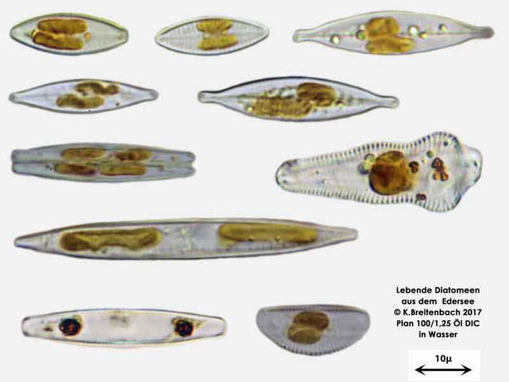 Bild 2 Diatomeen aus dem Edersee, lebende Exemplare