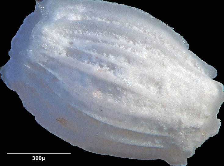 Foraminifere, Foraminifera, Bryozoa, Senckenberg, fossil, Stevns Klint, Dänemark, Maastrichtium