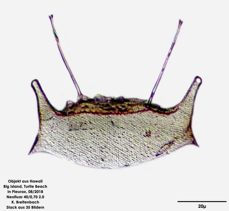 Diatome marin, Hawaii, USA, Odontella mobiliensis