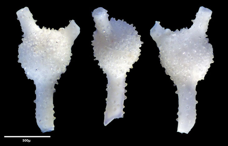 Foraminifere aus Aachen (Unt. Maastrichtium) Gattung: Ramulina sp T.R. Jones in Wright, 1875