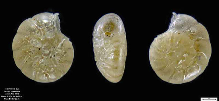 Foraminifere aus Radoy, Norwegen. Art: Ammonia beccarii (Linné 1758 )